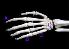Which of the following is the metacarpal bone?
A. a
B. b
C. c
D. d