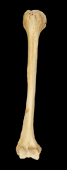 Identify the bone and the orientation