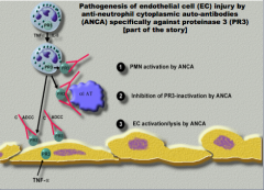 1. PMN activation by ANCA
2. Inhibition of PR3-inactivation by ANCA
3. EC activation/lysis by ANCA