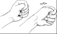 de Quervain's tenosynovitis


 


Patient grasps thumb against palm and moves wrist down


 


Pain = positive test
