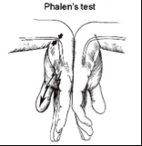 Median Nerve Compression; Carpal Tunnel Syndrome


 


Patient holds wrists in flexion with backs of hands together for 60 seconds


 


Numbness and tingling in the median nerve distribution = positive test