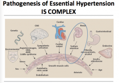 Overview of all the things that contribute to essential hypertension.