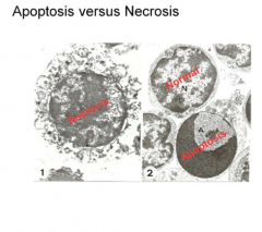 Necrosis is diff. from apoptosis in that it is NOT programmed and is "messy"


 


*Disordered, not programmed


*No signaling


*Cell contents spill out


*Promotes tissue injury & inflammation


 