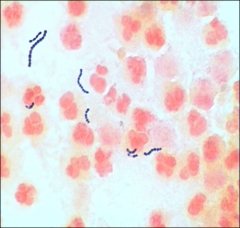 how does streptococcus pyogenes (group A strep) appear on gram stain?