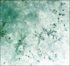 how does corynebacterium diphtheriae appear on methylene blue stain?