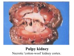 excess pericardial fluid
endorcardial haemorrhages
swollen viscera
congested and friable liver
pale and swollen kidneys- autolysed