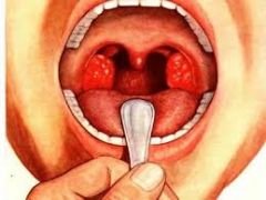 What Are the Masses of Lymphoid Tissues Located Under the Mucous Membranes in the Mouth/Throat Called? Name the Four Parts.