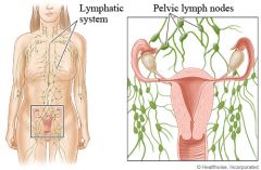 What is Another Name for Pelvic Lymph Nodes?