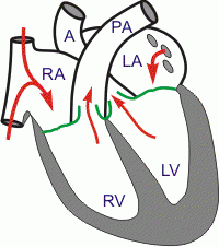 What happens during Ventricular Ejection?