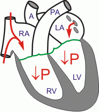 What happens during Isovolemic Relaxation of ventricles?
