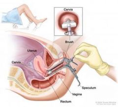 439. Diagnostik bei vaginalem bzw. zervikalem Fluor: