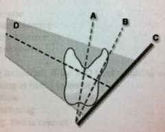 A is?
a. Central ray
b. Longitudinal axis of tooth
c. Imaginary bisecting line
d. Plane of film