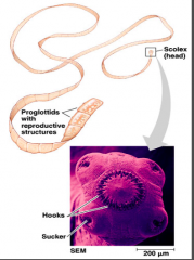 Platyhelminths
Cestoda
 (tapeworms)
