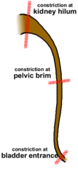 1. at renal pelvis and ureter junction
2. at bifurcation of common iliac vessel
3. Junction of ureter entering the bladder.