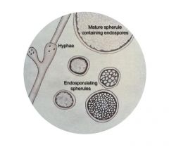 
A fungus spore borne within a cell or within the tubular end of a sporophore