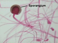 
A single-celled or many-celled structure in which spores are produced