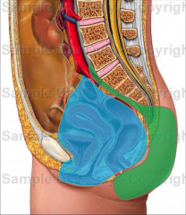 posterior: supplies posterior abdomen and pelvic wall


anterior: suplies pelvic viscera and perineum, medial compartments of the thigh, via obturator artery