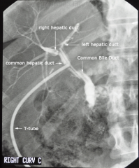 X-ray recording of the bile ducts after dye is injected intravenously or percutaneously, or is given orally and directed by the liver into the bile ducts