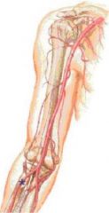 In onderstaande afbeelding zie je een tekening van de arteriële vaatboom van de arm. De arm is getoond in de anatomische stand.
Wat is de naam van het met een asterisk (*) gemarkeerde bloedvat?
a. a. ulnaris
b. a. radialis
c. a. cephalica
d. a. b...