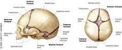 Anatomical feature of an infant skull - soft membranous sutures between cranial bones - allows for rapid stretching and deformation of the neurocranium.