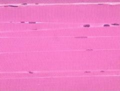 Onderstaande afbeelding toont een microscopische opname van een histologisch gekleurd biopt. De kleur van de bewerkte coupe zegt echter niets over de kleur van dit weefsel in vivo.


Drie beweringen hierover zijn:


1 Dit weefsel is van nature...