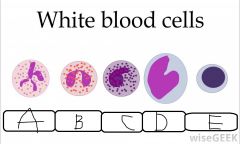 Which one is a Lymphocyte?