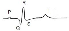 what does the flat line between the P and Q phase in an ECG correspond to