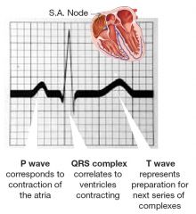 ventricular contraction/depolarisation