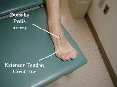 dorsal pedis artery is on the dorsum of the foot


-palpated as crosses over navicular and cuneiform bones just lateral to EHL


-must palpate to rule out intermittent claudication