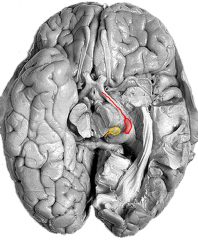 medial (yellow) and lateral (red) genculate bodies