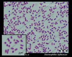 Hemophilus influenzae