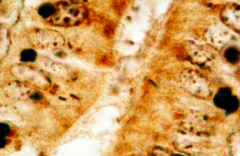 Proliferative enteropathies (Lawsonia intracellularis) 
 