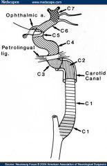 1. Cervical
2. Petrous (horizontal)
3. Lacerum 
4. Cavernous 
5. Clinoid
6. Ophthalmic (supraclinoid)
7. Communicating (terminal)
image02
