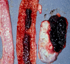 Proliferative hemorrhagic enteropathy 
(Lawsonia intracellularis)