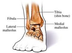 distal end of fibula forms lateral malleolus


lateral malleolus lies more inferior and posterior than medial