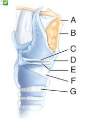 Which structure in the figure is the hyoid bone?