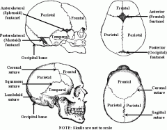 Anterior suture, separates frontal bone from parietals