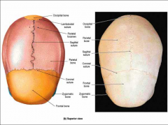 Intersection of coronal and sagittal sutures (landmark)