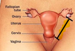Uterine fundus --> into inguinal canal --> labia majora 