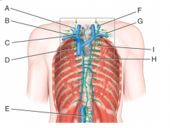 In the diagram this vessel drains lymph from the upper right side of the body into venous blood using a subclavian vein.