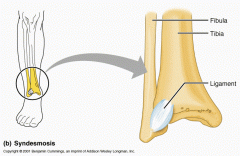 Bones connected by a ligament (band) of fibrous tissue
Vary in length (longer than in suture) - length determines movement
E.g. ligament connecting tibia and fibular - functionally immoveable - Tibiofibular joint
(kind of immoveable)