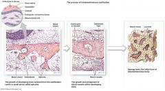 Steps of intramembranous ossification: