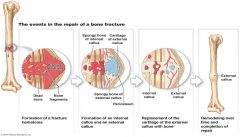 Fibrocartilage callus formation