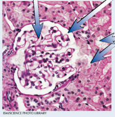 Label this image of the renal cortex.