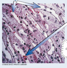 Label this image of a renal medulla