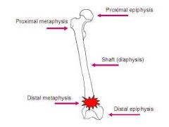 Types of Fractures
Epiphyseal =