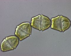 Alveolata Dinoflagellates