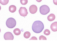 The darker purple cells are called what? 

This is a type of what?