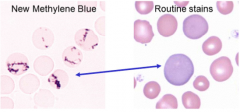If you saw a polychromatophil that stained like this with NMB stain, what cell would you have? 

What is this best evidence of?