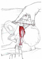 Udspring: Anterior flade af sacrum
Insertion: Trochanter major
Funktion: Lat. rotation af hofte og abduktion af hofte, når hoften er flekteret. Derudover vigtig stabilisator af hoften.

